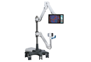 DYSIS® – Colposcopia digitale computer-assistita